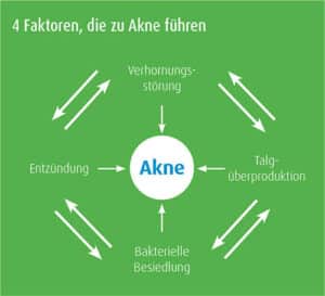 4 Fakten für Akne