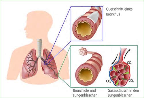 Menschliche Lunge mit Bronchien, Bronchiolen und Lungenbläschen