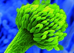 Mukoviszidose Aspergillus Fumigatus