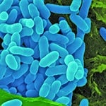 Mukoviszidose - Burkholderia pseudomallei