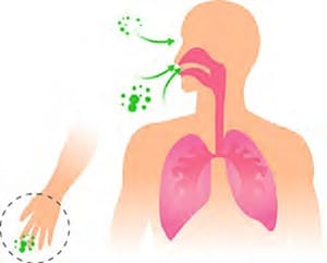 Infektionsweg Pseudomonas aeruginosa