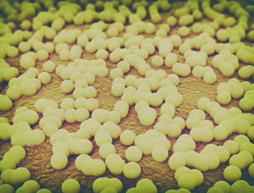 Staphylococcus aureus Haufenkokken