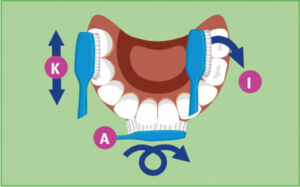 Zahnung Zahnpflege Kai-System