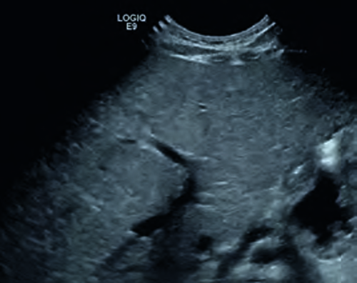 Ultraschall Frühgeborene