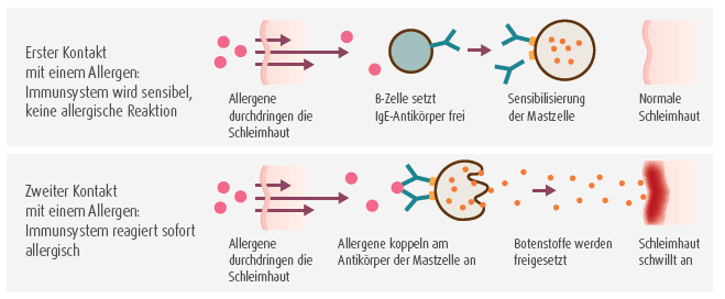 Wie entsteht eine Allergie